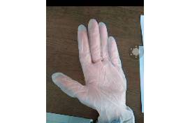 Can Disposable Gloves Help Prevent Infection With a Novel Coronavirus?